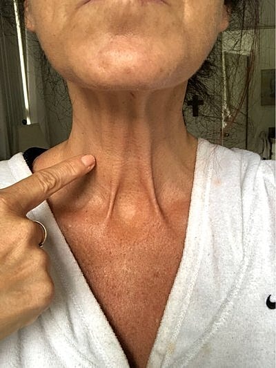 Person pointing at pronounced neck tendons.