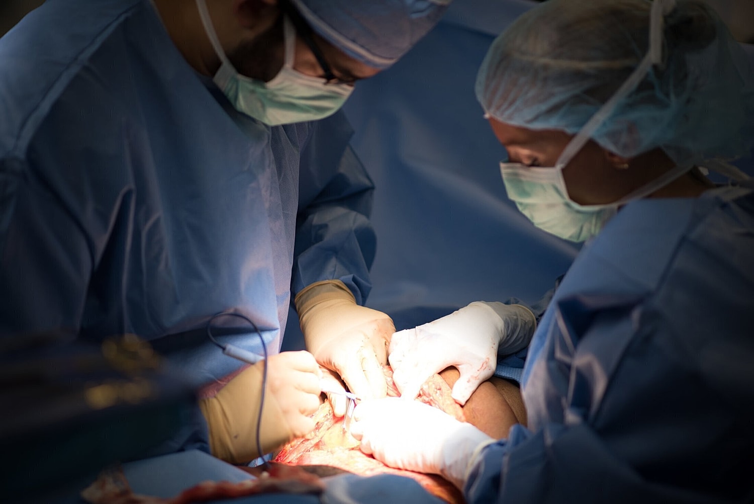 orlando plastic surgeon and assistants performing a tummy tuck on a patient