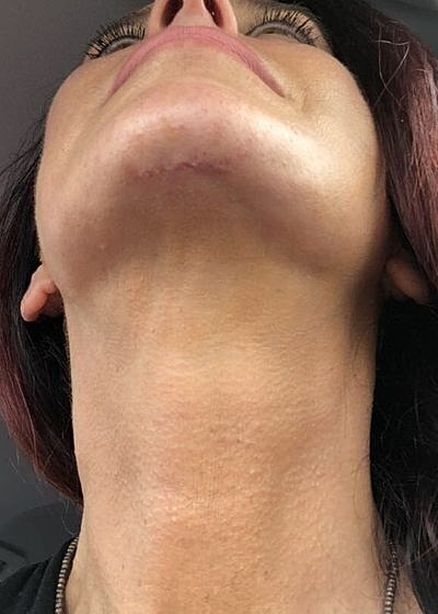 Close-up of neck and chin angle.