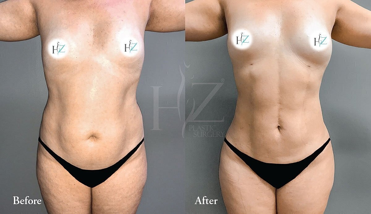 Before and after plastic surgery transformation image.