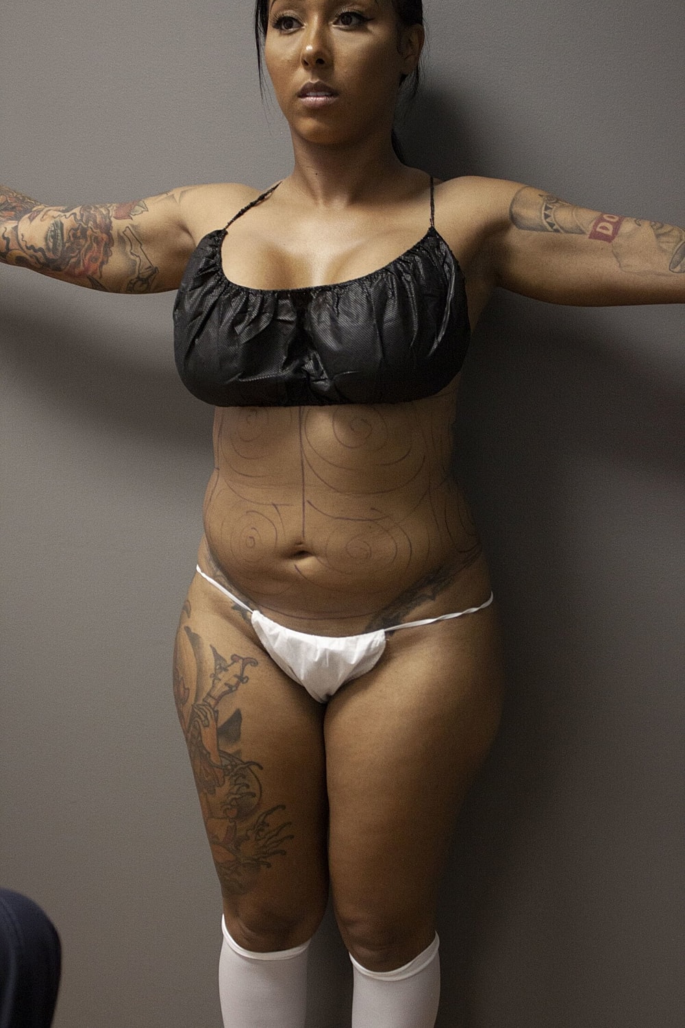 Person displaying body art and preparation for procedure.